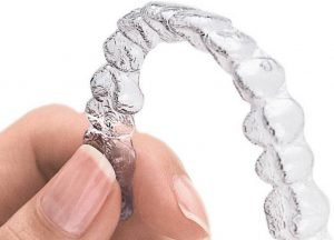 invisalign-braces